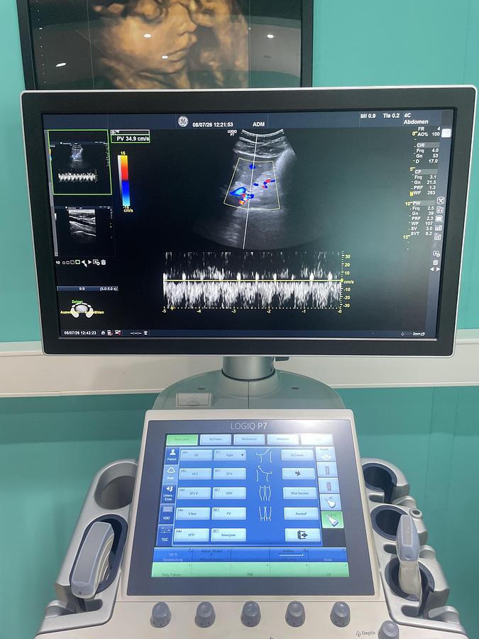 Gebraucht GE LOGIQ P7 Ultraschallgerät mit zwei Sonden