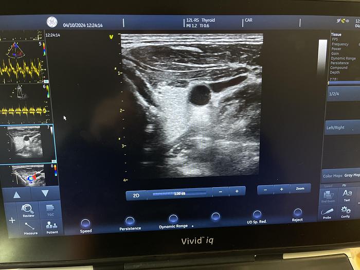 Used GE L12-RS Linear Ultraschallsonde