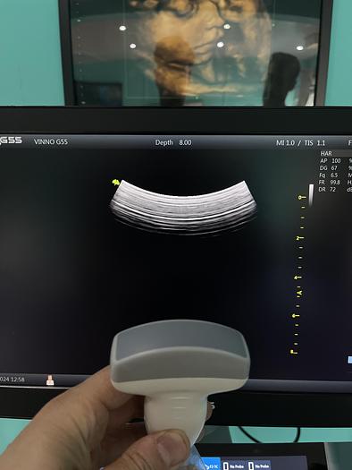 Used Vinno G55 Ultraschallgerät mit Konvex Sonde