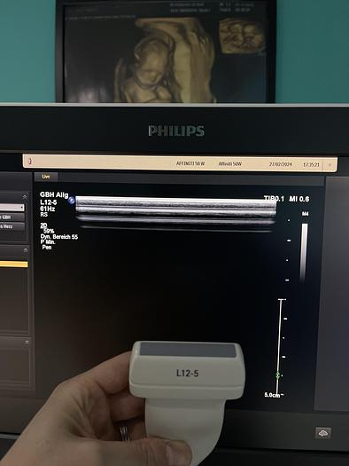 Gebraucht Philips Affiniti 50W Ultraschallgerät mit 3 Sonden und Drucker SV 9.0.5