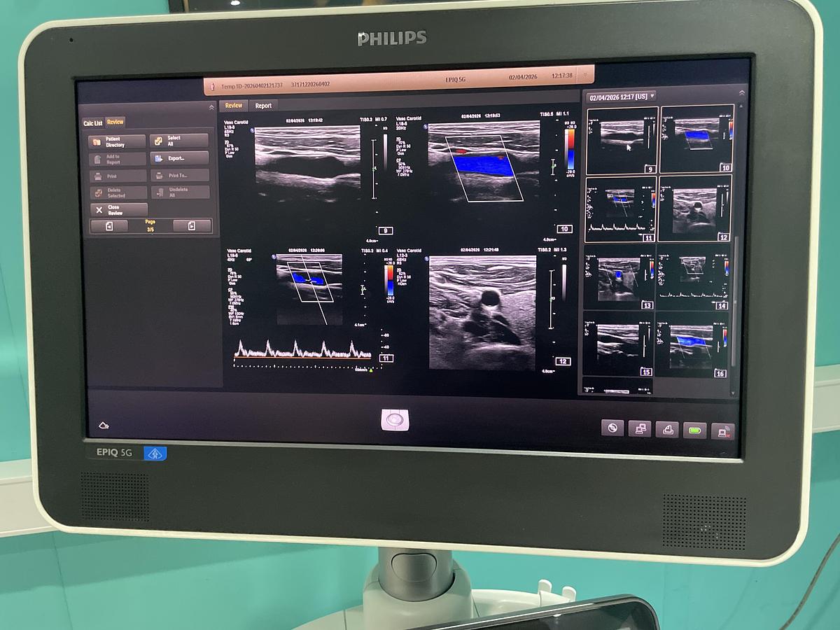 Gebraucht Philips Epiq 5G Ultraschallgerät mit drei Sonden