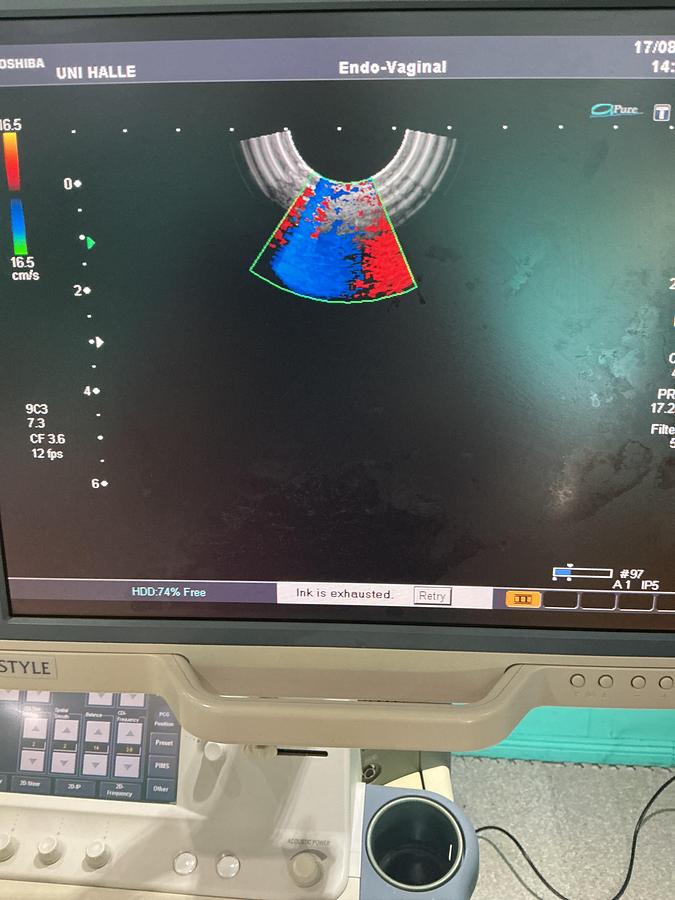 Gebraucht Toshiba iSTYLE Ultraschallgerät mit zwei Sonden 