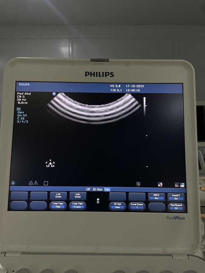 Gebraucht Philips C8-5 Mikro Konvex Ultraschallgerät