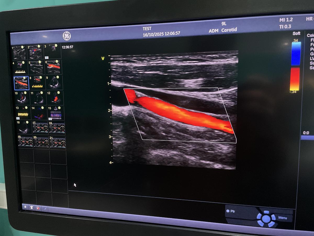 Gebraucht GE Vivid E95 v202 Ultraschallgerät mit zwei Sonden