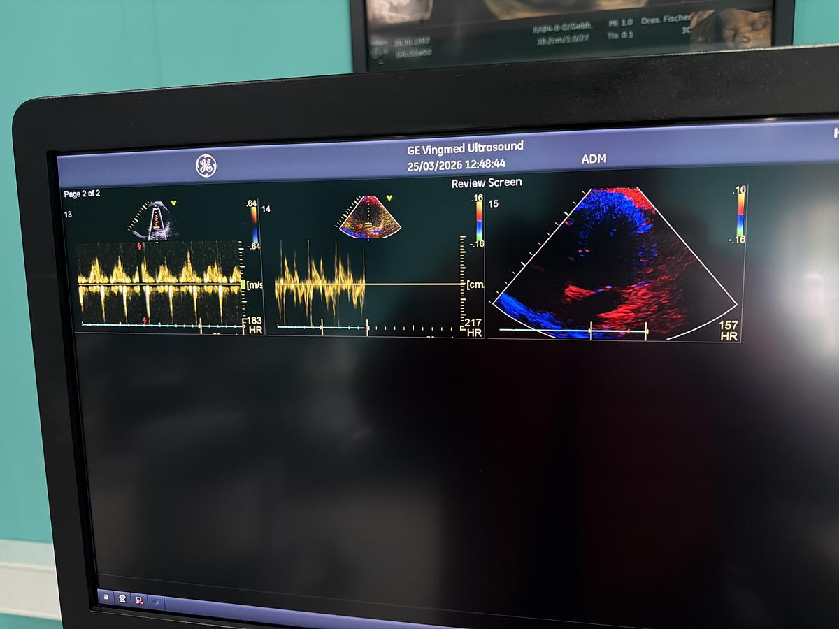Gebraucht GE Vivid E95 v202 Ultraschallgerät mit zwei Sonden 