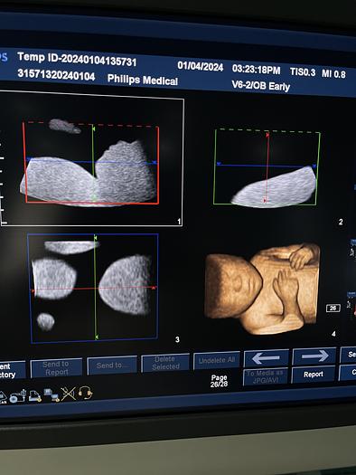 Gebraucht Philips iU22 Ultraschallgerät mit drei Ultraschallsonden
