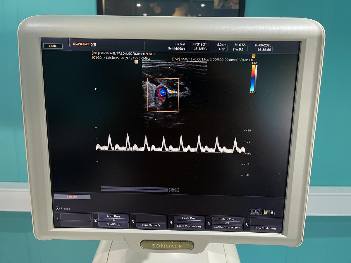 Gebraucht SonoAce X8 Ultraschallgerät mit drei Sonden und Drucker