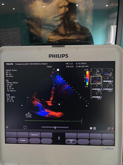 Gebraucht Philips CX50 Purewave Ultraschallgerät mit kardio Sonde
