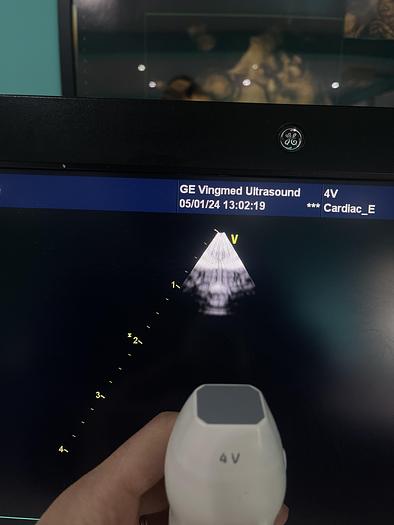 Gebraucht GE Healthcare Vivid E9 Ultraschall Gerät mit zwei Sonden