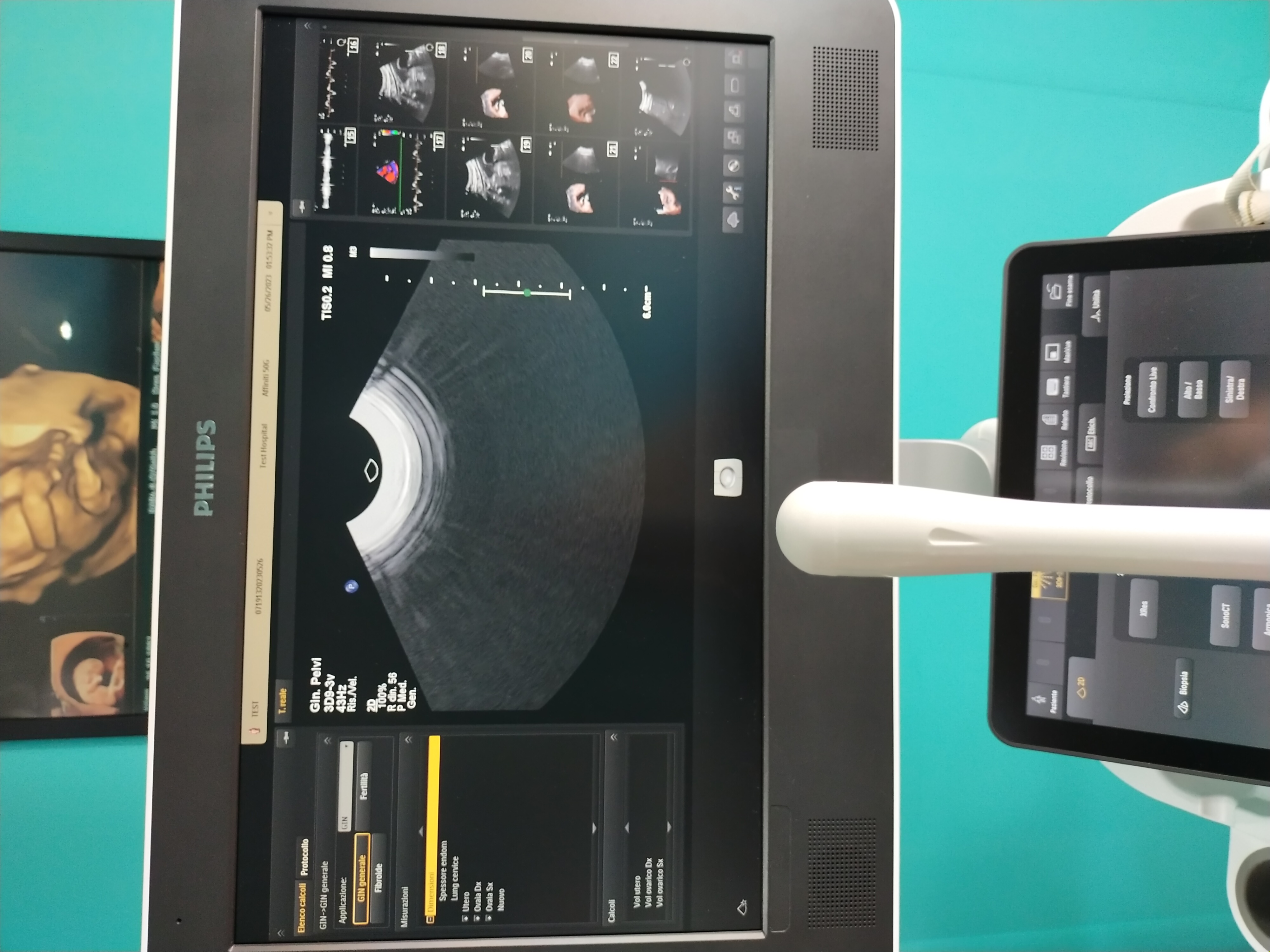 Philips 3D9-3v Transvaginal Ultraschallsonde 4D OB/GYN