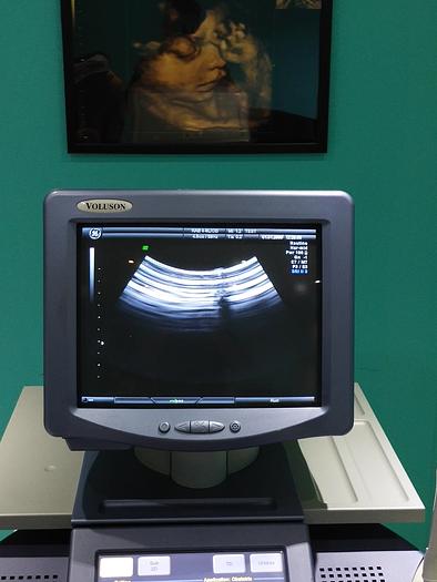 Gebraucht  GE-Voluson 730 Expert Ultraschallgerät 