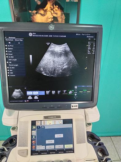 Gebraucht GE LOGIQ E9 Flachbildschirm-Ultraschallgerät