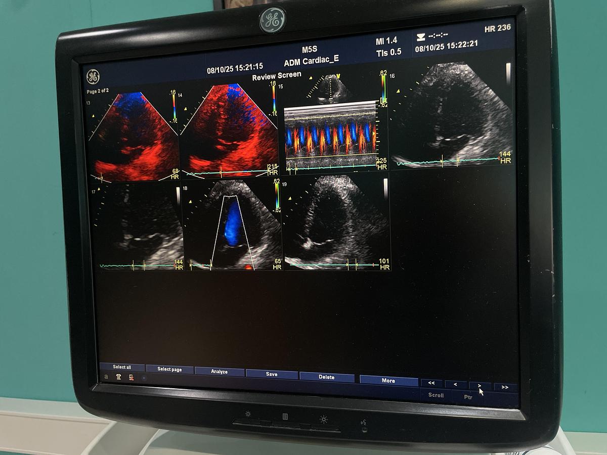 Gebraucht GE Vivid E9 Ultraschallgerät mit zwei Sonden und Drucker