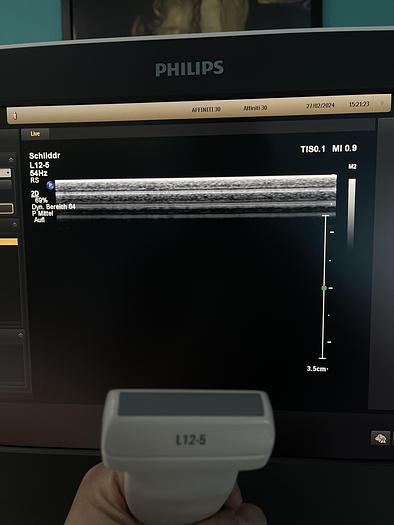Used Philips Affiniti 30 Ultraschallgerät mit 3 Sonden und Drucker