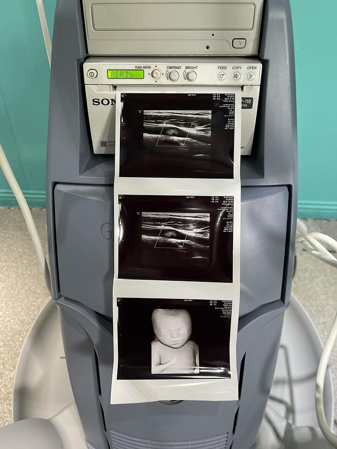 Gebraucht GE Voluson S8 Ultraschallgerät mit drei Sonden und Drucker