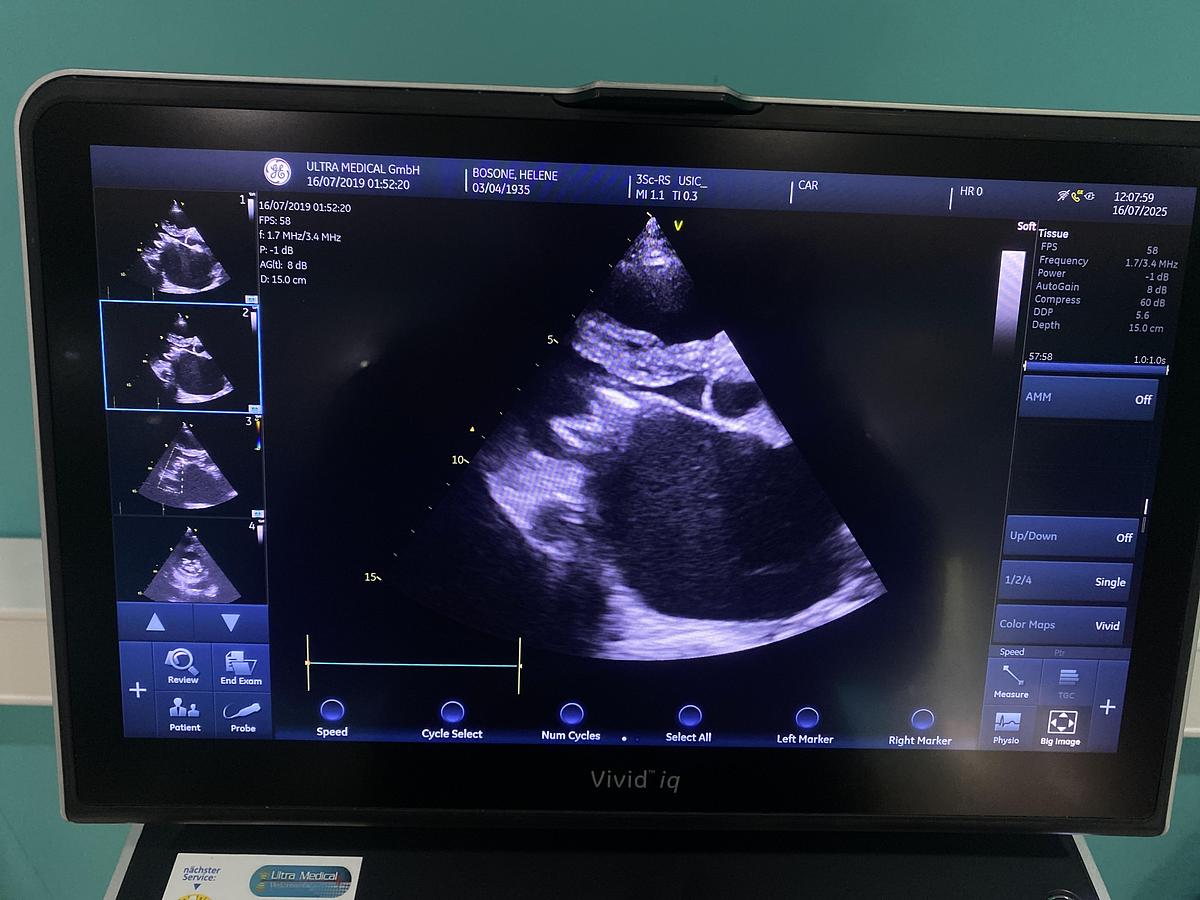 Gebraucht GE Vivid iq Ultraschallgerät mit M5Sc-RS Kardiosonde