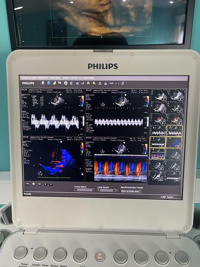 Gebraucht Philips CX50 Ultraschallgerät mit Sektor Sonde Model Version 5.0.2