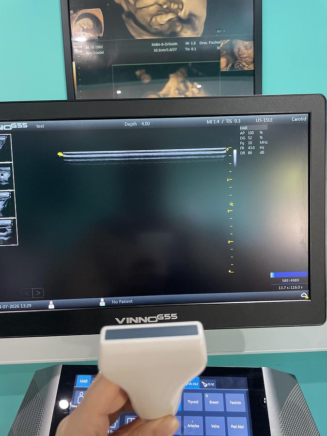 Gebraucht VINNO G55 Ultraschallgerät mit zwei Sonden und Drucker