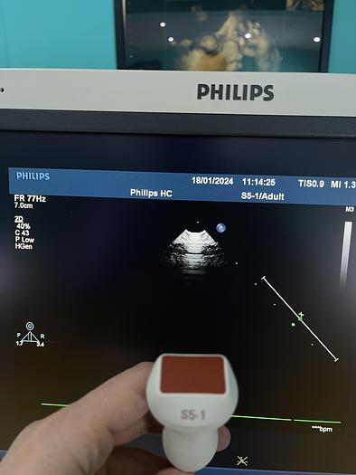 Gebraucht Philips iE33 Ultraschallgerät