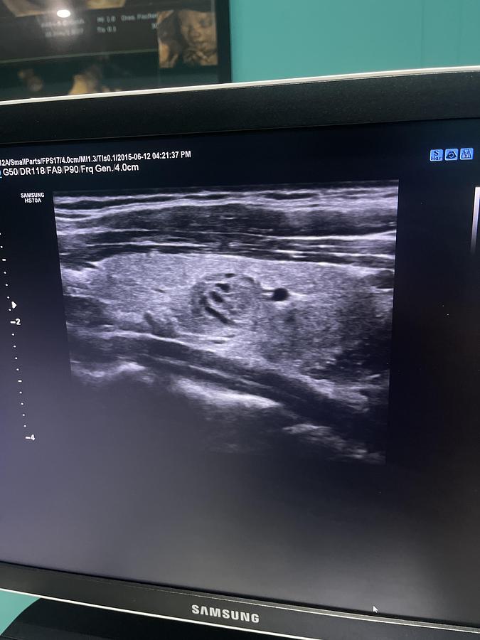 Gebraucht Samsung HS70A Ultraschallgerät mit drei Sonden