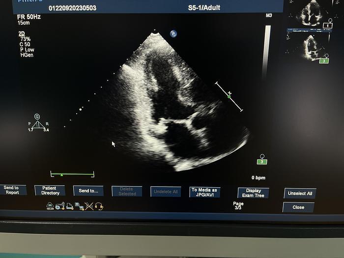 Gebraucht Philips iE33 Ultraschallgerät