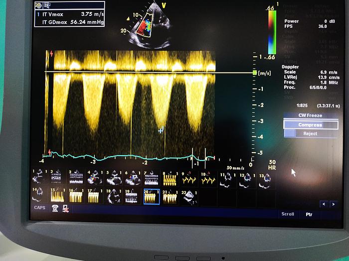 Gebraucht GE Vivid 7 Ultraschallgerät