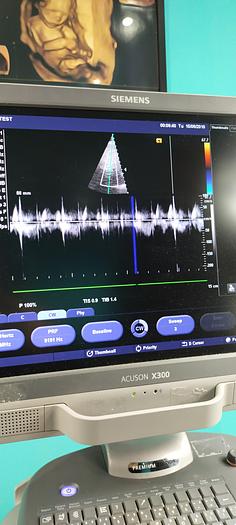 Gebraucht Siemens Acuson X300 Ultraschallgerät mit 3 Sonden