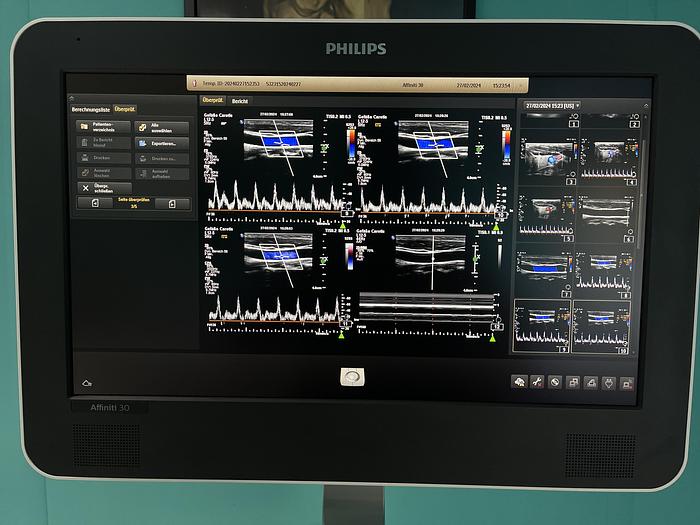 Used Philips Affiniti 30 Ultraschallgerät mit 3 Sonden und Drucker
