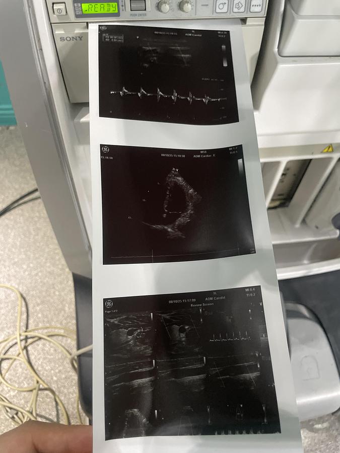 Gebraucht GE Vivid E9 Ultraschallgerät mit zwei Sonden und Drucker