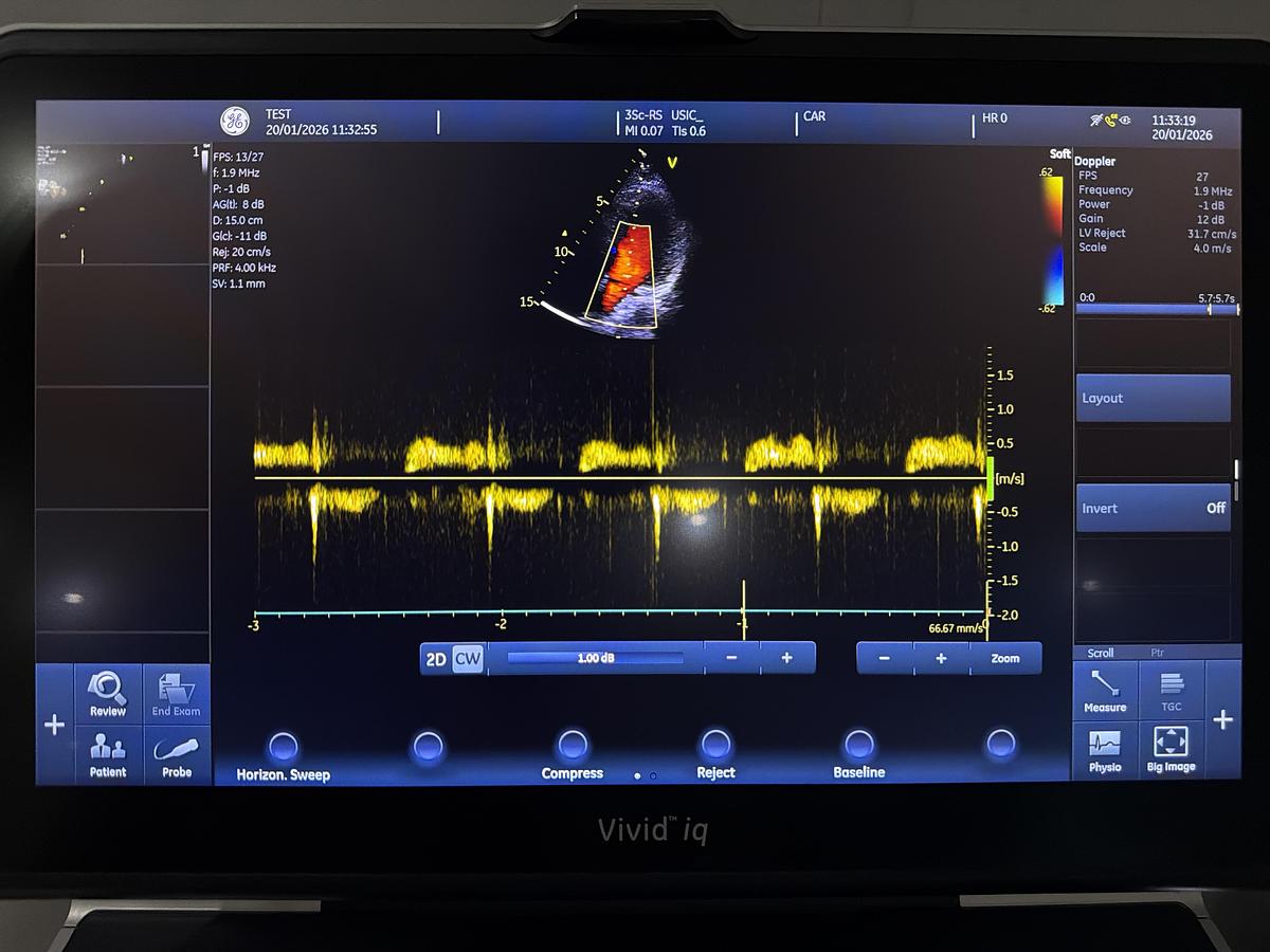 Gebraucht GE 3SC-RS Kardio Ultraschallsonde 