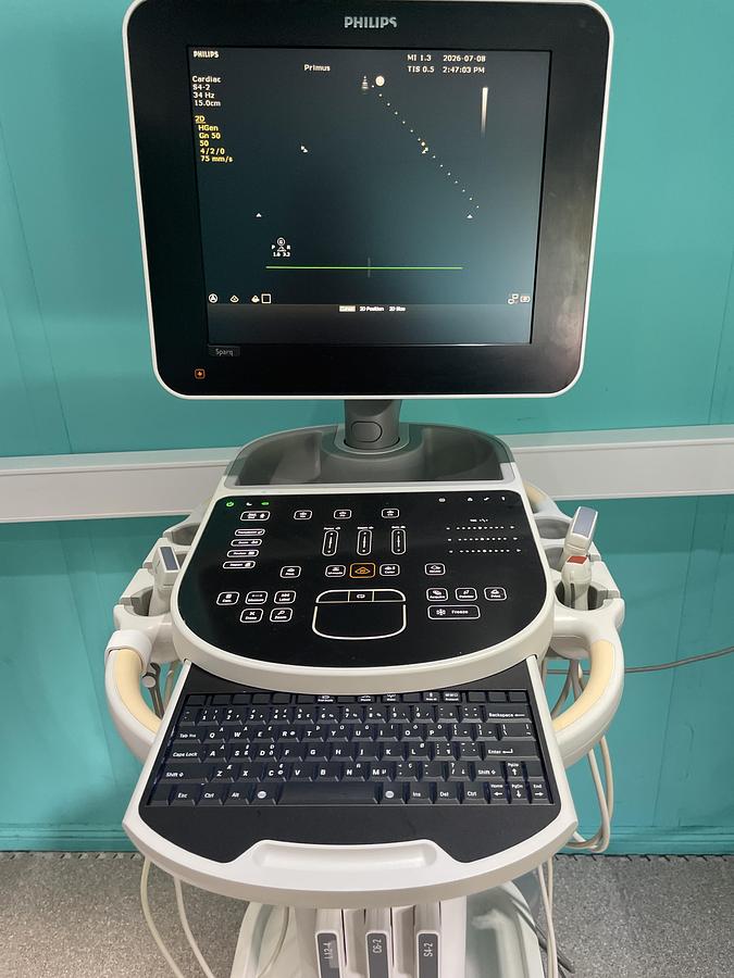 Gebraucht Philips Sparq Ultraschallgerät mit drei Sonden und Drucker