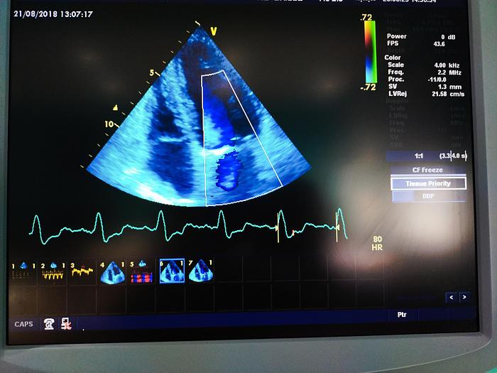 Gebraucht GE Vivid 7 Ultraschallgerät