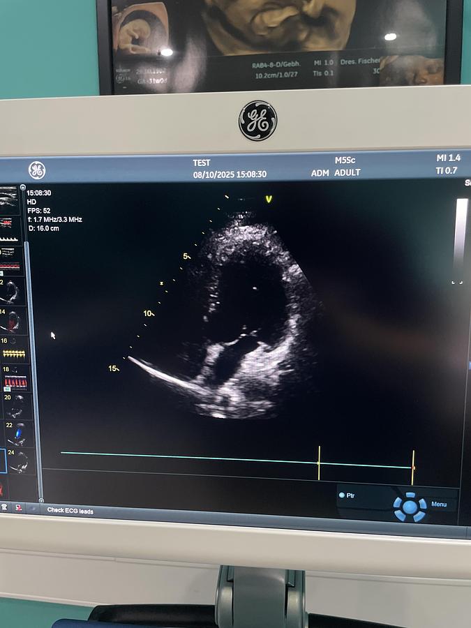 Gebraucht GE Vivid S70 Ultraschallgerät mit zwei Sonden