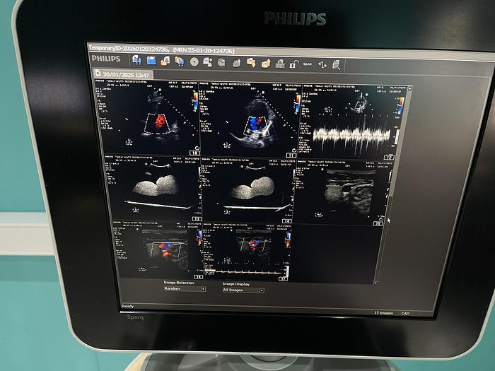 Gebraucht Philips Sparq Ultraschallgerät mit drei Sonden