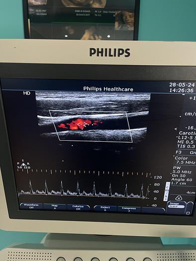 Gebraucht Philips L12-5 50 Linear Ultraschallsonde