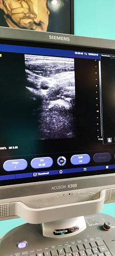 Gebraucht Siemens Acuson X300 Ultraschallgerät mit 3 Sonden