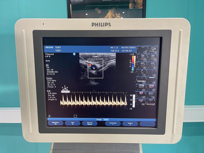 Used Philips HD 11 XE  Ultraschallgerät mit drei Sonden und Drucker