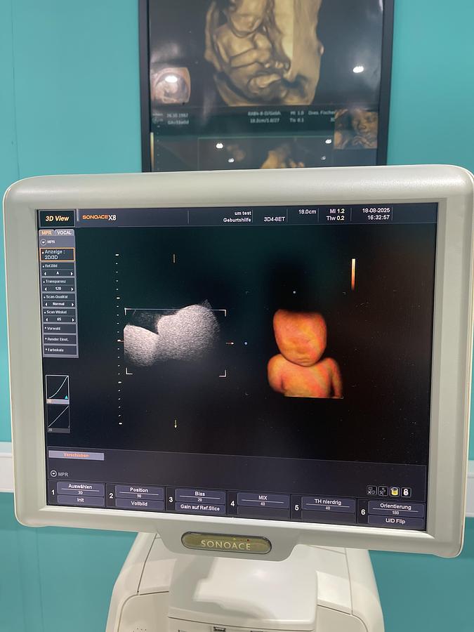 Gebraucht SonoAce X8 Ultraschallgerät mit drei Sonden und Drucker