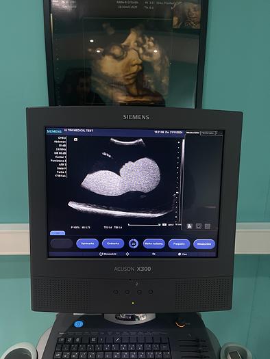 Used Siemens ACUSON X300 Ultraschallgerät mit drei Sonden 