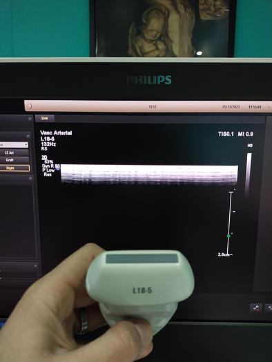 Gebraucht Philips L18-5 Ultraschallsonde 