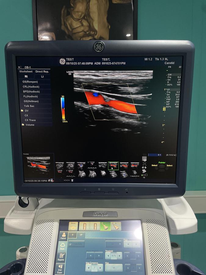 Gebraucht GE LOGIQ E9 Ultraschallgerät mit 2 Sonden und Drucker