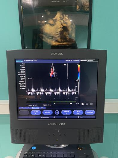 Used Siemens ACUSON X300 Ultraschallgerät mit drei Sonden 