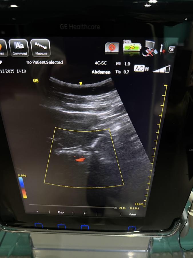 Gebraucht GE Venue 40 Ultraschallgerät mit Konvex Sonde