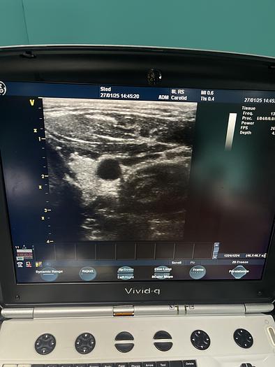 Used GE 8L-RS Linear Ultraschallsonde 