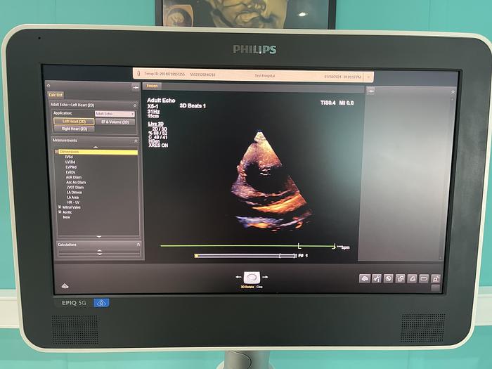 Used Philips EPIQ 5G Ultraschallgerät mit zwei Sonden