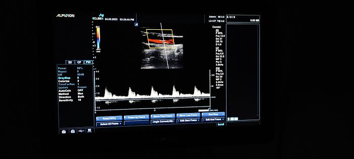 Gebraucht Alpinion ECUBE 5 Flachbildschirm-Ultraschallgerät inkl. 2 sonden Ultrasound