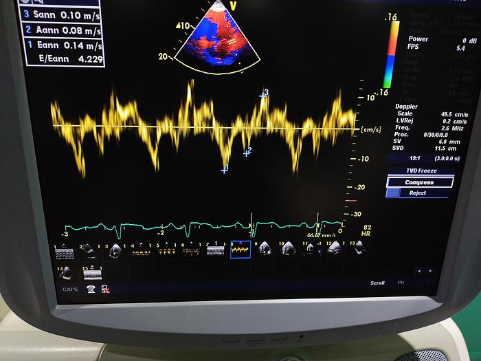 Gebraucht GE Vivid 7 Ultraschallgerät