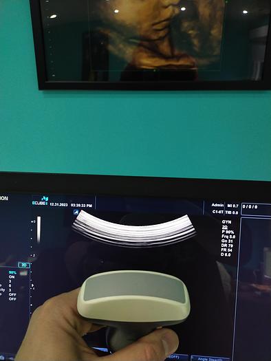 Gebraucht Alpinion ECUBE 5 Flachbildschirm-Ultraschallgerät inkl. 2 sonden Ultrasound