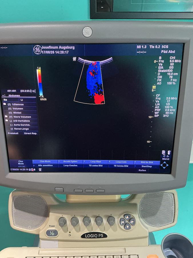 Gebraucht GE Logiq P5 Ultraschallgerät mit zwei Sonden