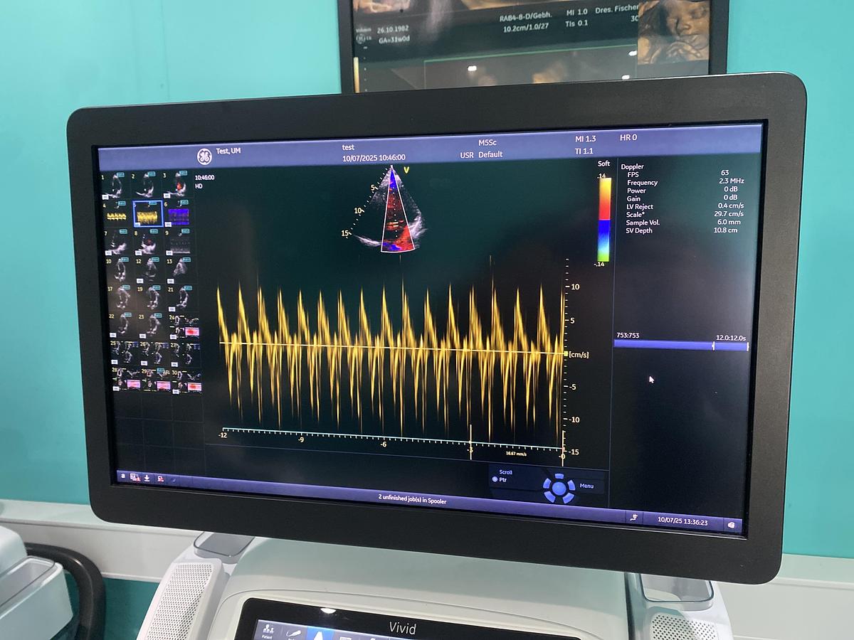 Gebraucht GE Vivid E95 V204 Ultraschallgerät mit M5Sc-D Kardiosonde